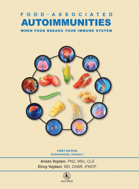 Food-Associated Autoimmunities : When Food Breaks Your Immune System, Hardback Book
