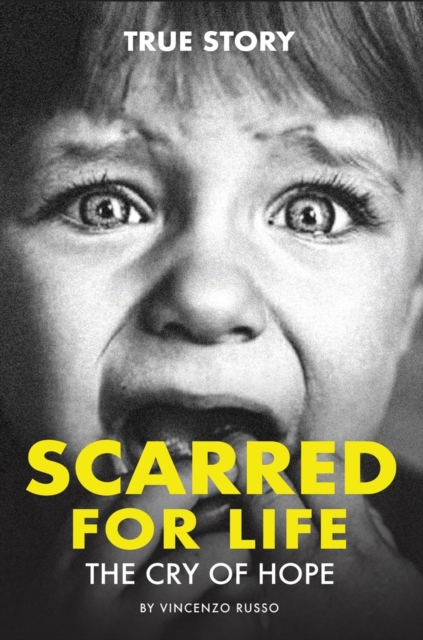 Scarred for Life : The Cry Of Hope, Hardback Book