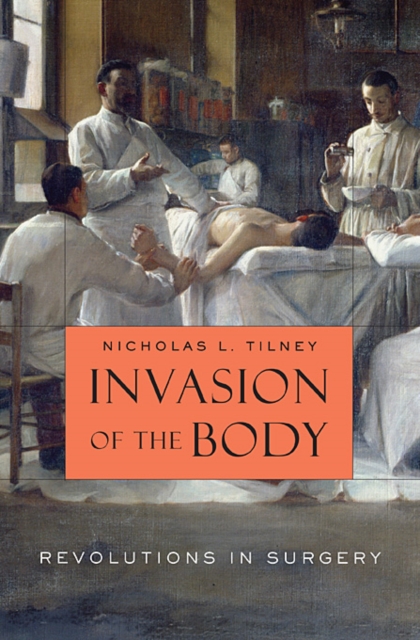 Invasion of the Body : Revolutions in Surgery, Hardback Book