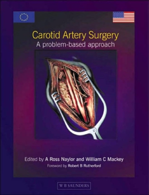 Carotid Artery Surgery : A Problem-based Approach, Hardback Book