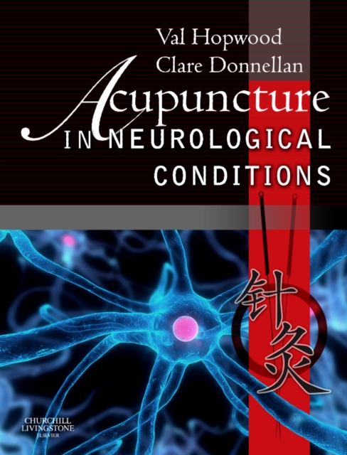 Acupuncture in Neurological Conditions, Paperback / softback Book