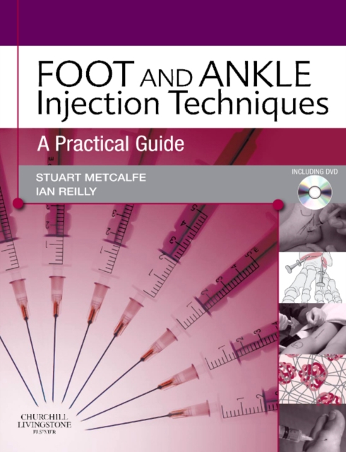 Foot and Ankle Injection Techniques : A Practical Guide, Hardback Book