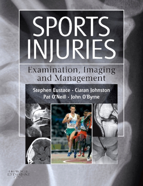 E-Book - Sports Injuries : E-Book - Sports Injuries, PDF eBook