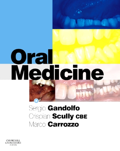 Oral Medicine E-Book : Oral Medicine E-Book, PDF eBook