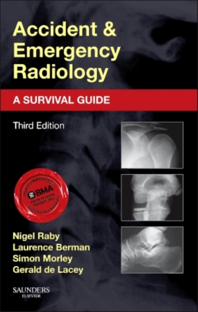 Accident and Emergency Radiology: A Survival Guide, Paperback / softback Book