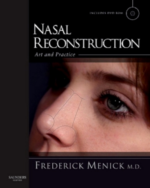 Nasal Reconstruction: Art and Practice, PDF eBook