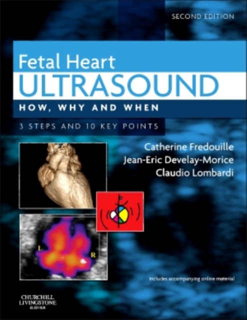 Fetal Heart Ultrasound : How, Why and When, Hardback Book