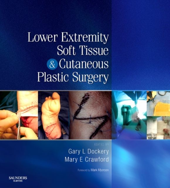 Lower Extremity Soft Tissue & Cutaneous Plastic Surgery E-Book : PAPERBACK, PDF eBook