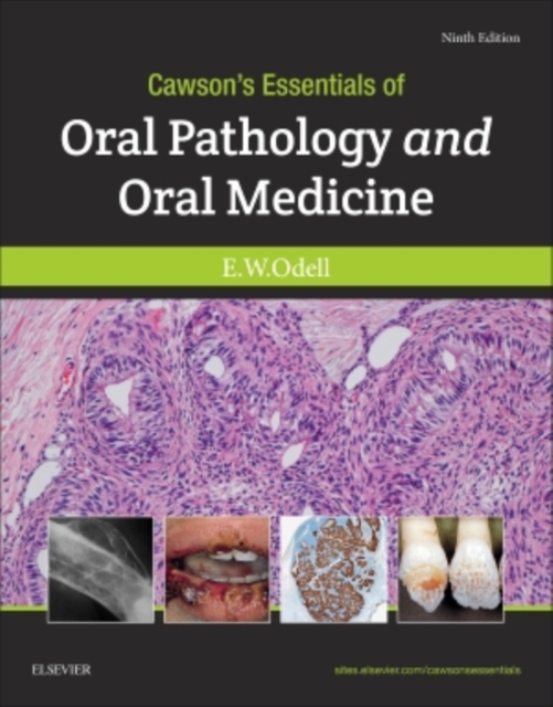 Cawson's Essentials of Oral Pathology and Oral Medicine, Paperback / softback Book