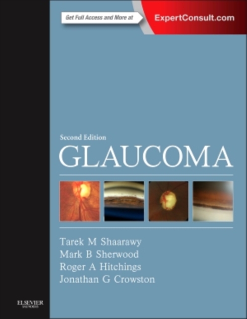 Glaucoma, Multiple-component retail product Book