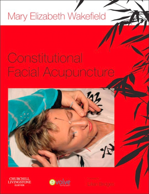 Constitutional Facial Acupuncture, EPUB eBook