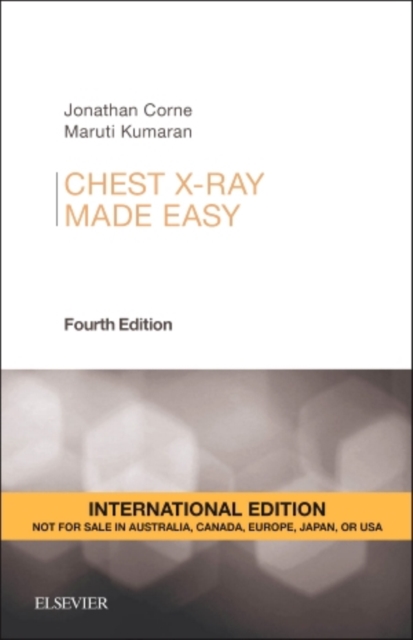 Chest X-Ray Made Easy, Paperback Book