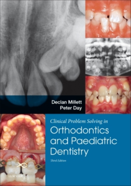 Clinical Problem Solving in Dentistry: Orthodontics and Paediatric Dentistry, Paperback / softback Book