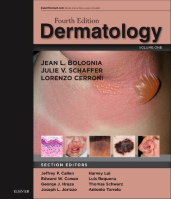 Dermatology: 2-Volume Set, Multiple-component retail product Book