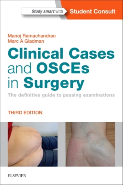 Clinical Cases and OSCEs in Surgery : The definitive guide to passing examinations, Paperback / softback Book