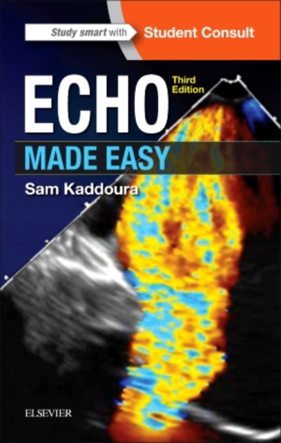 Echo Made Easy, Paperback / softback Book