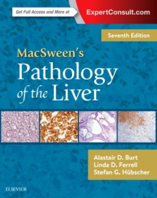 MacSween's Pathology of the Liver, Hardback Book