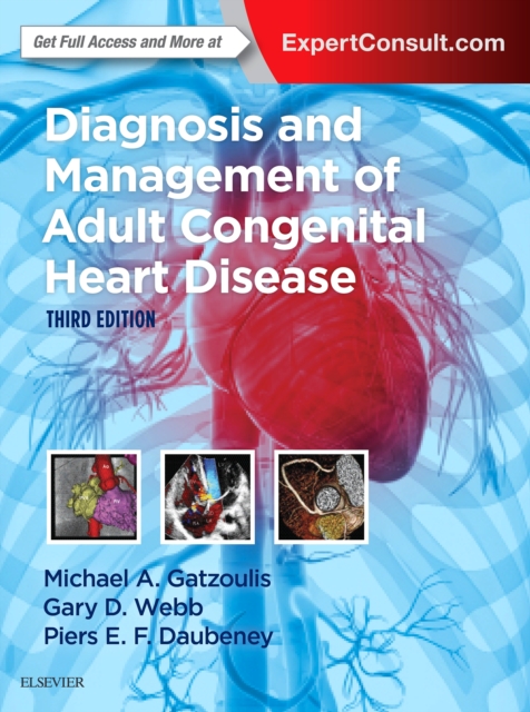 Diagnosis and Management of Adult Congenital Heart Disease E-Book, PDF eBook
