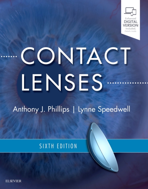 Contact Lenses, Hardback Book
