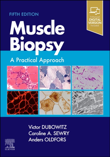 Muscle Biopsy : A Practical Approach, Hardback Book