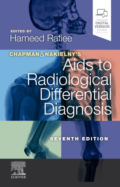 Chapman & Nakielny's Aids to Radiological Differential Diagnosis, Paperback / softback Book