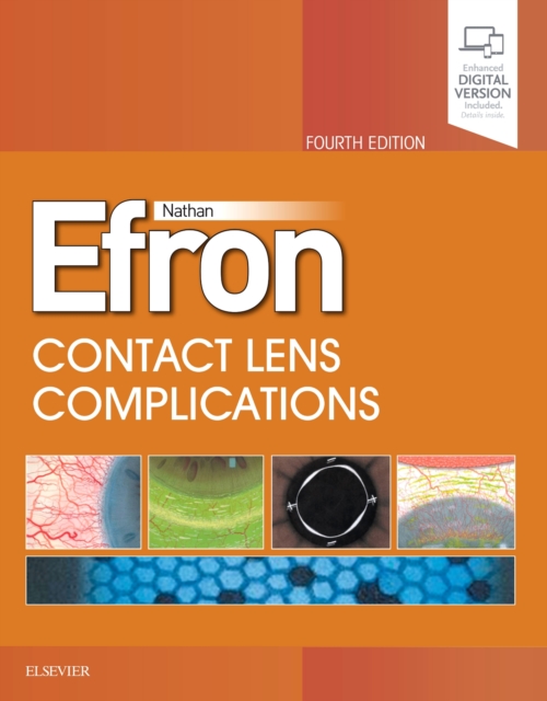 Contact Lens  Complications, Hardback Book
