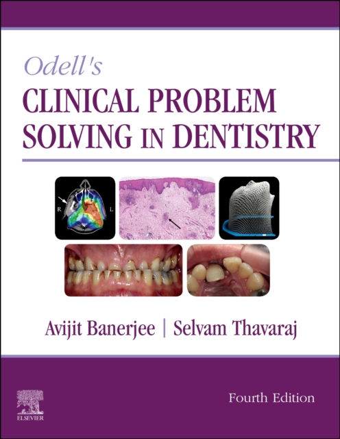 Odell's Clinical Problem Solving in Dentistry, Paperback / softback Book