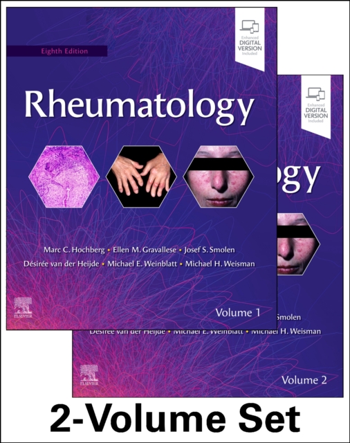 Rheumatology, 2-Volume Set, Multiple-component retail product Book
