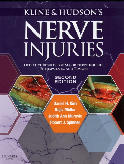 Kline and Hudson's Nerve Injuries : Operative Results for Major Nerve Injuries, Entrapments and Tumors, Hardback Book