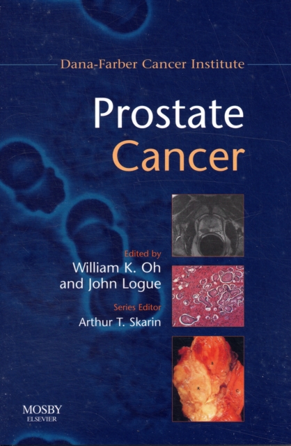 Prostate Cancer, Paperback Book