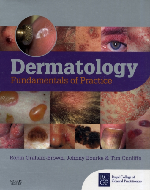 Dermatology : Fundamentals of Practice, Paperback / softback Book