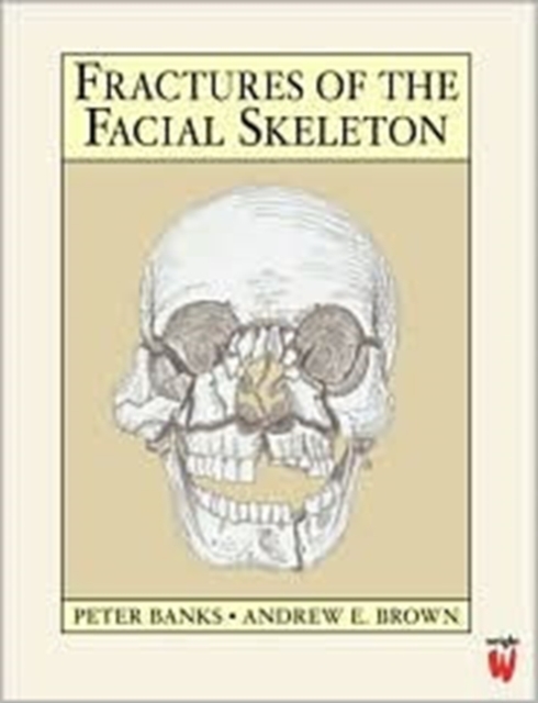 Fractures of the Facial Skeleton, Paperback / softback Book