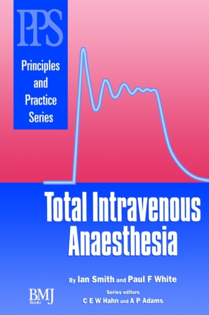 Total Intravenous Anaesthesia, Paperback / softback Book