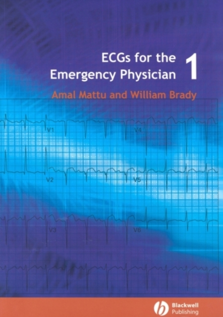 ECGs for the Emergency Physician 1, Paperback / softback Book