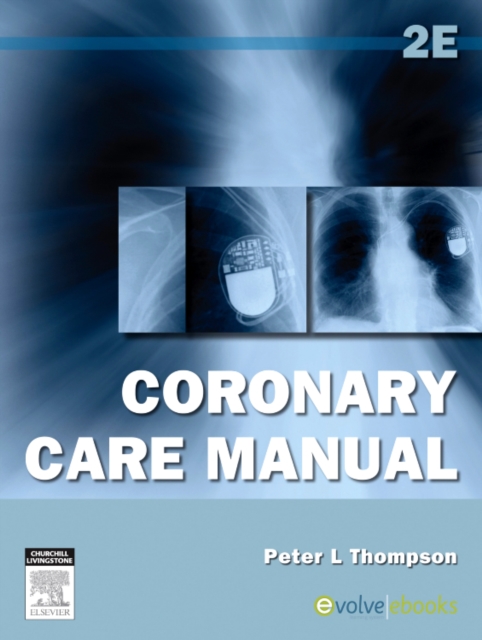Coronary Care Manual, Paperback / softback Book