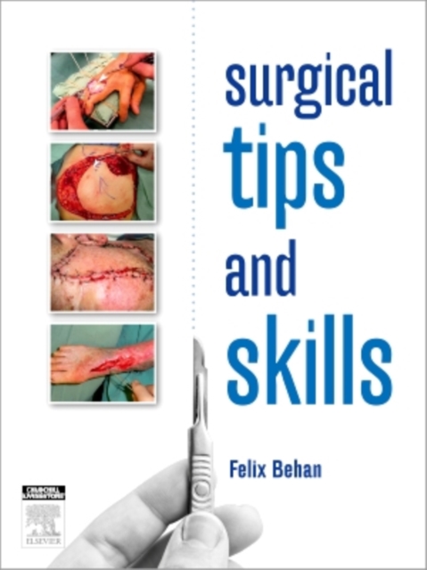 Surgical Tips and Skills, Paperback / softback Book