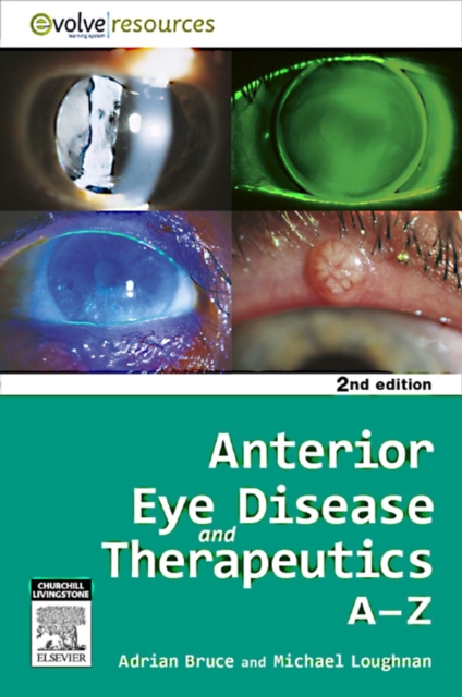 Anterior Eye Disease and Therapeutics A-Z - E-Book, EPUB eBook