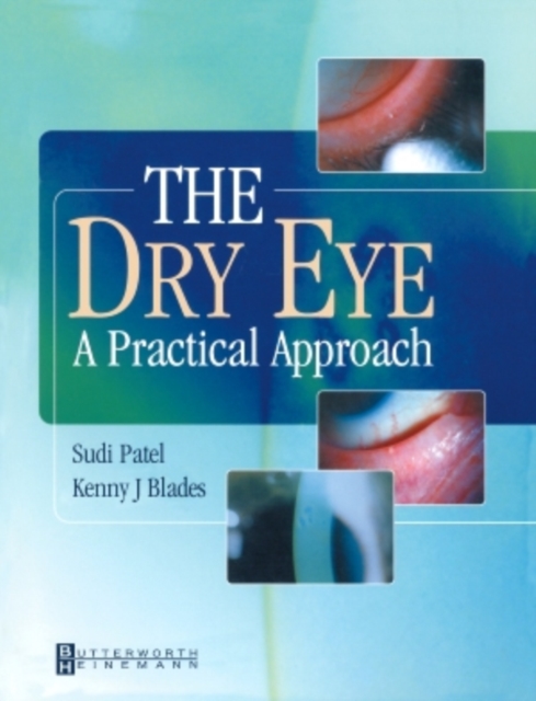 The Dry Eye : A Practical Approach, Paperback / softback Book