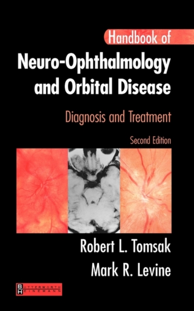 Handbook of Neuro-Ophthalmology : Diagnosis & Treatment, Paperback / softback Book