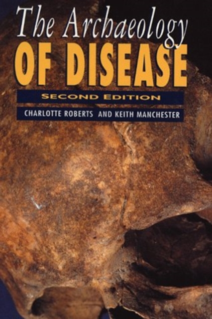 The Archaeology of Disease, Paperback / softback Book