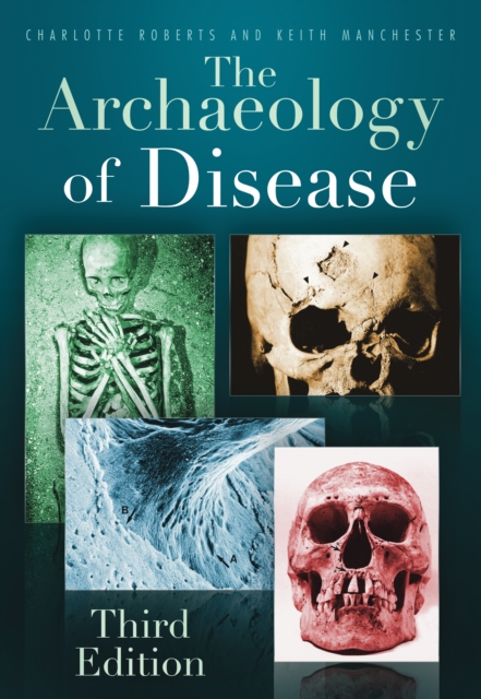 The Archaeology of Disease : Third Edition, Paperback / softback Book