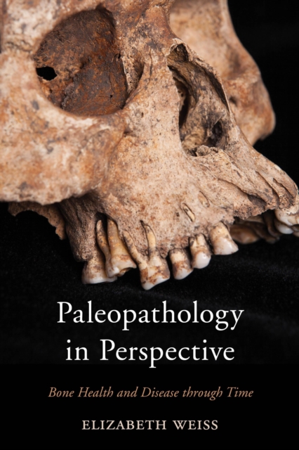 Paleopathology in Perspective : Bone Health and Disease through Time, Paperback / softback Book