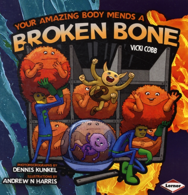Your Amazing Body Mends a Broken Bone, Paperback / softback Book
