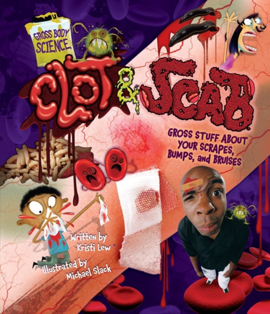 Clot & Scab : Gross Stuff about Your Scrapes, Bumps, and Bruises, PDF eBook