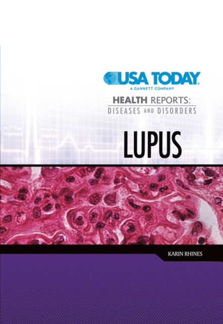 Lupus, PDF eBook