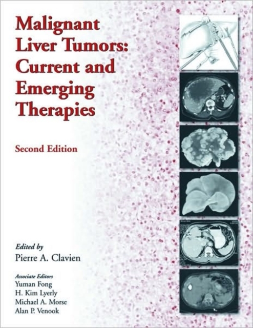 Malignant Liver Tumors : Current and Emerging Therapies, Hardback Book