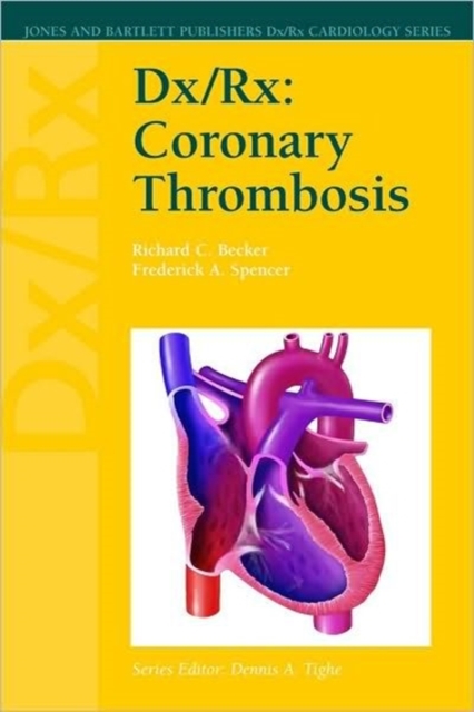 Dx/Rx : Coronary Thrombosis, Paperback / softback Book