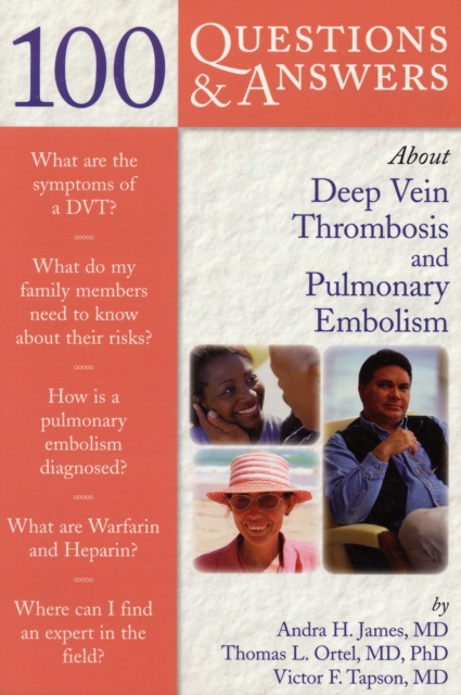 100 Questions  &  Answers About Deep Vein Thrombosis And Pulmonary Embolism, Paperback / softback Book
