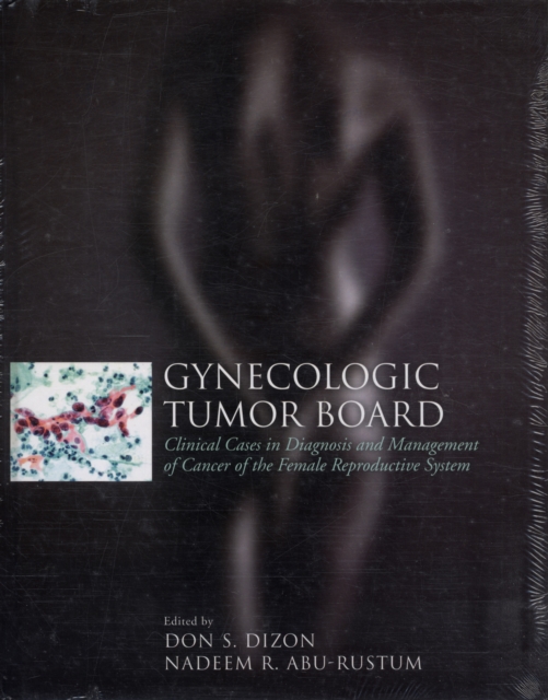 Gynecologic Tumor Board: Clinical Cases In Diagnosis And Management Of Cancer Of The Female Reproductive System, Hardback Book