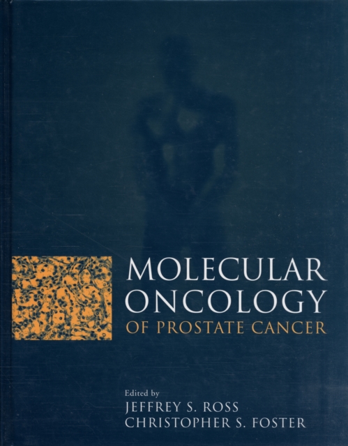 Molecular Oncology of Prostate Canc, Hardback Book